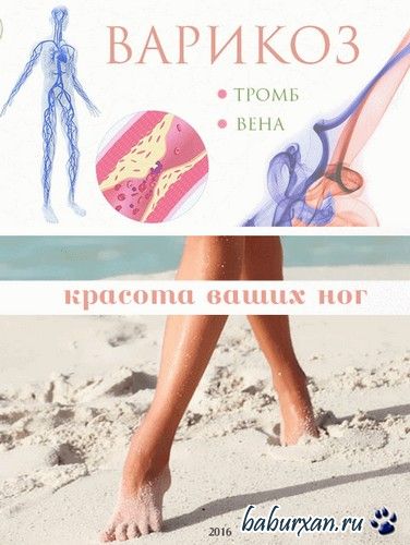 Здоровье и красота ваших ножек без варикоза (2016)